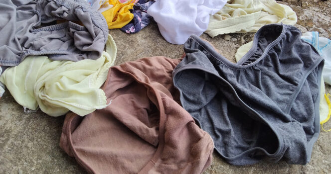 Reason behind the “bleach” patch on your underwear