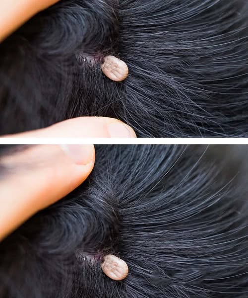 Just discovered this in my son’s hair. What is it? Not sure if we should go to doc